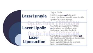 Lazer Liposuction ile Lazer Lipoliz Yöntemleri Arasında Ne Farklı Uygulanıyor