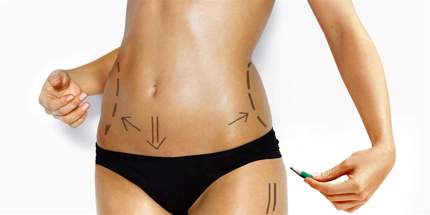 Karın Germe Ameliyatı ve Vaser Liposuction Birlikte Yapılırsa Estetik Sonuçlar.